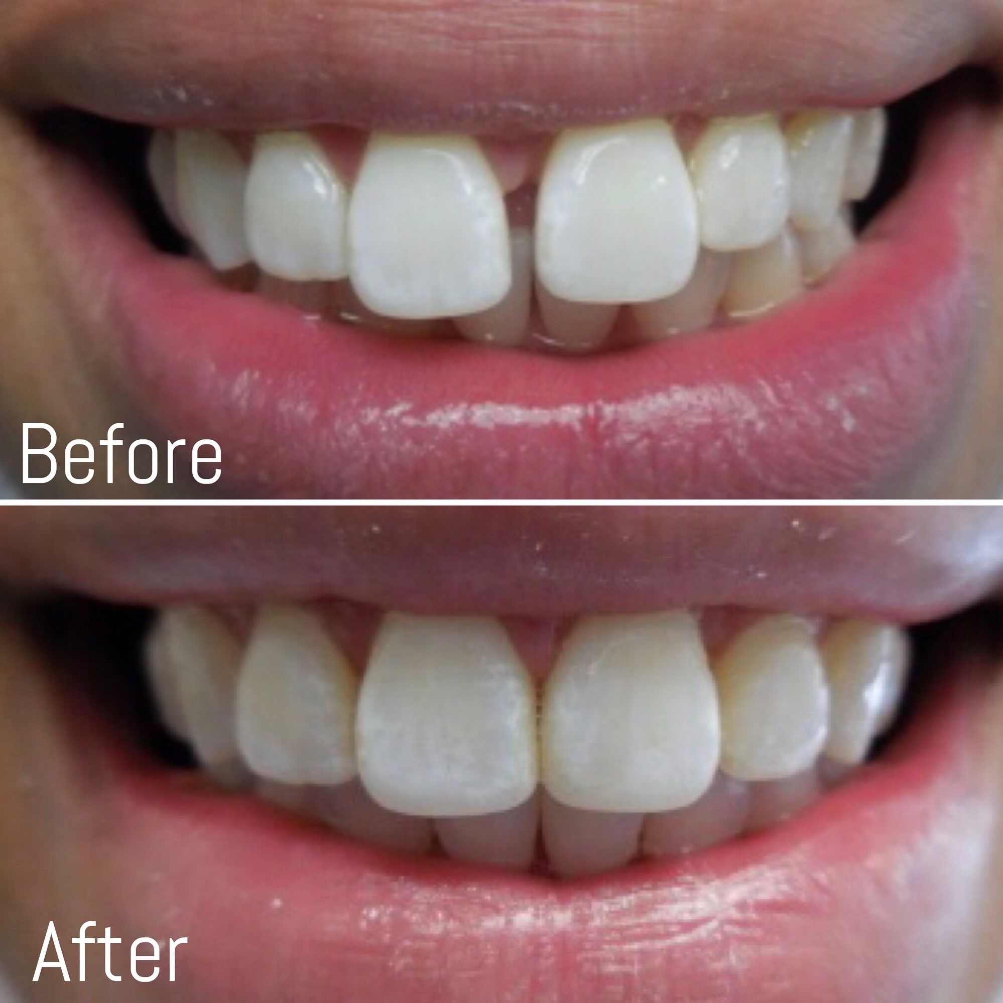 Cosmetic Dentistry 