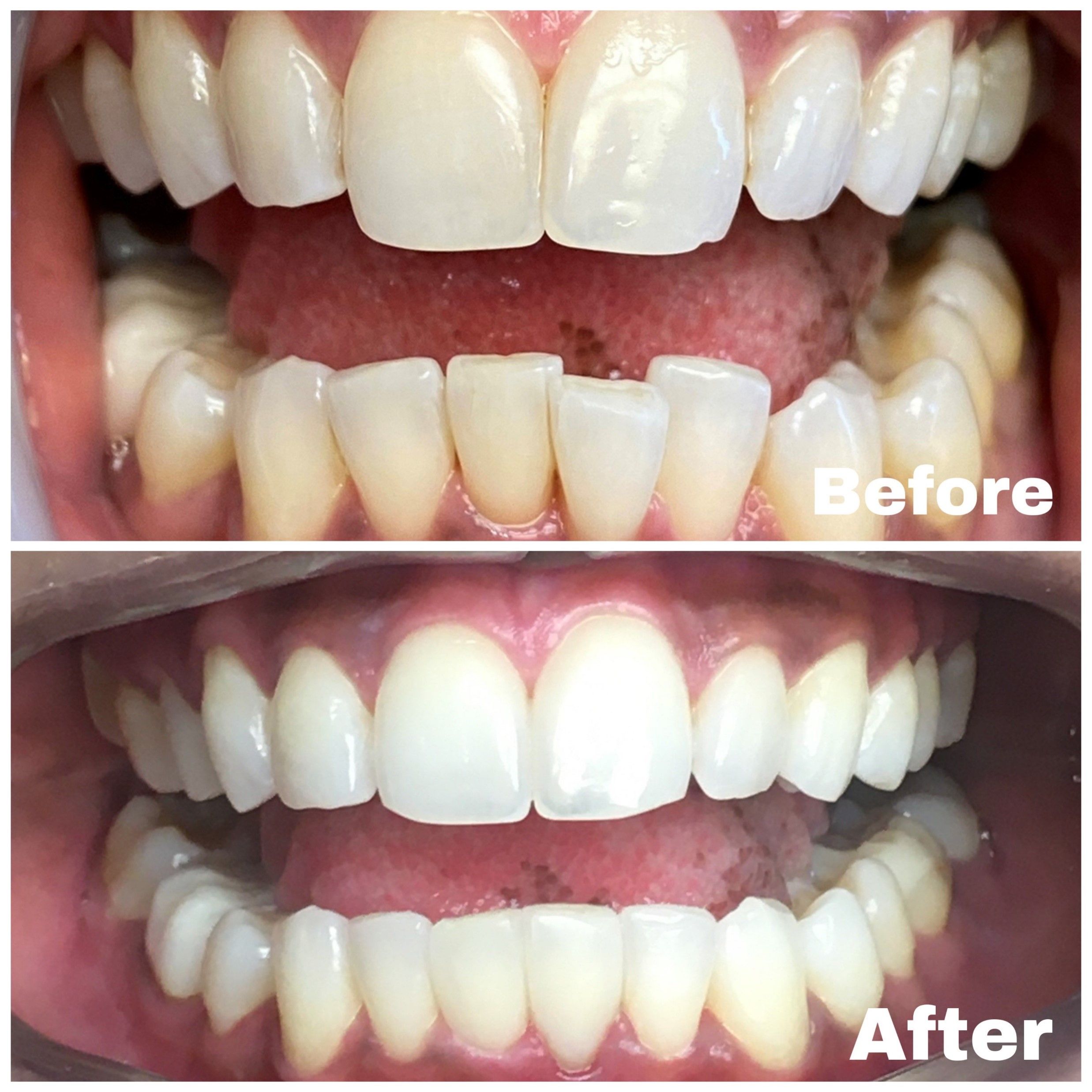 Cosmetic Dentistry 