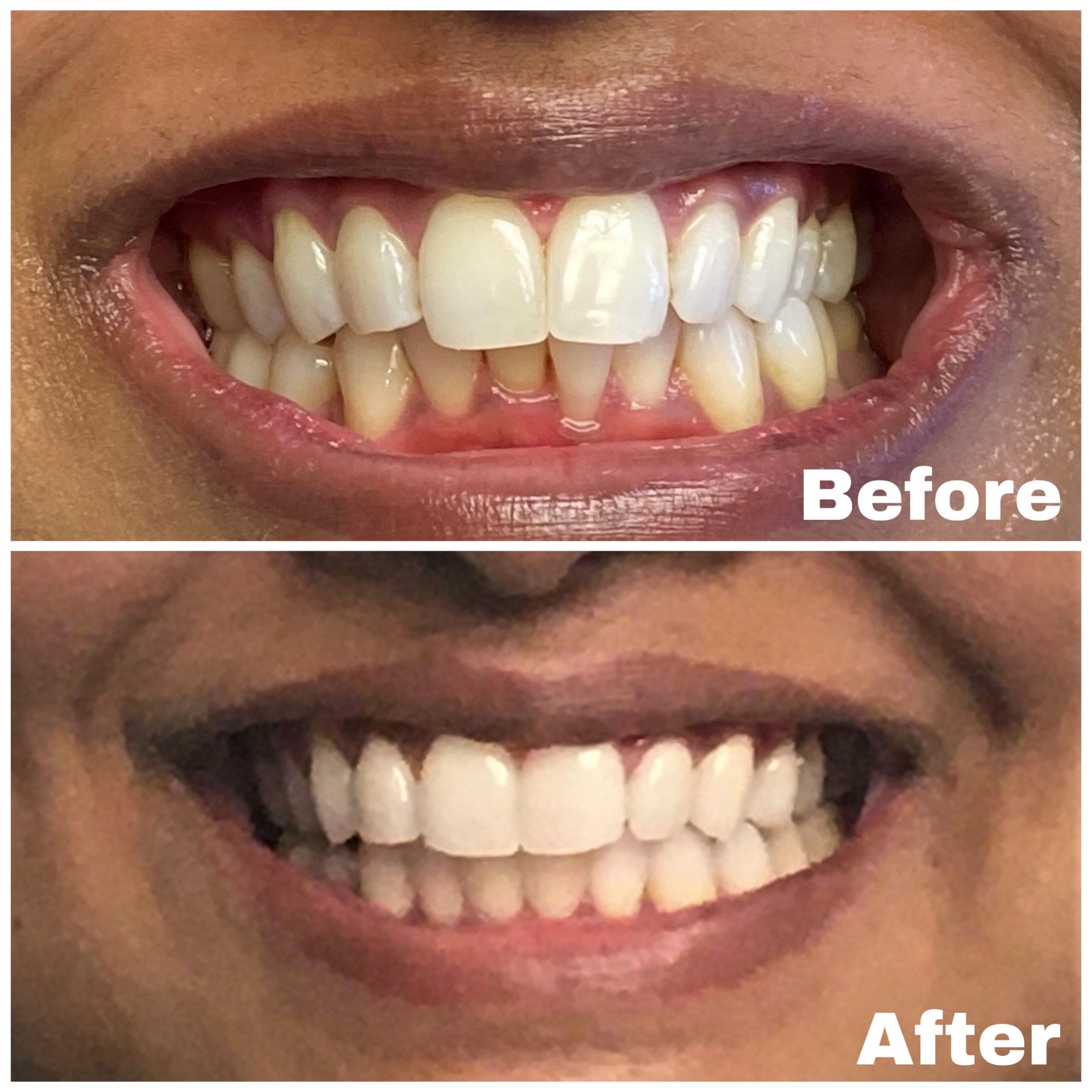 Cosmetic Dentistry 