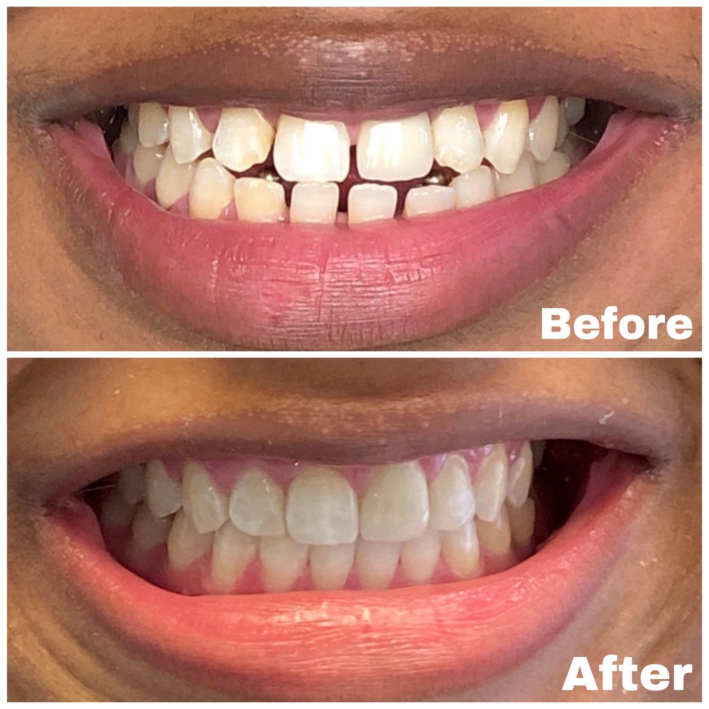 Cosmetic Dentistry 