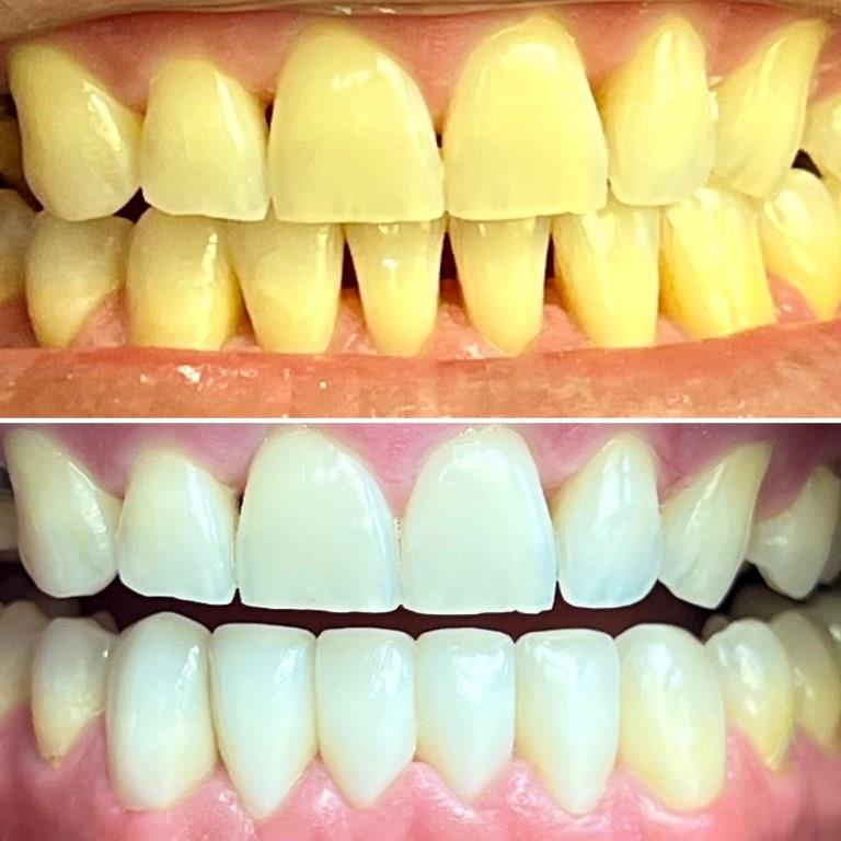BRIAN BEFORE AFTER BLACK TRIANGLE