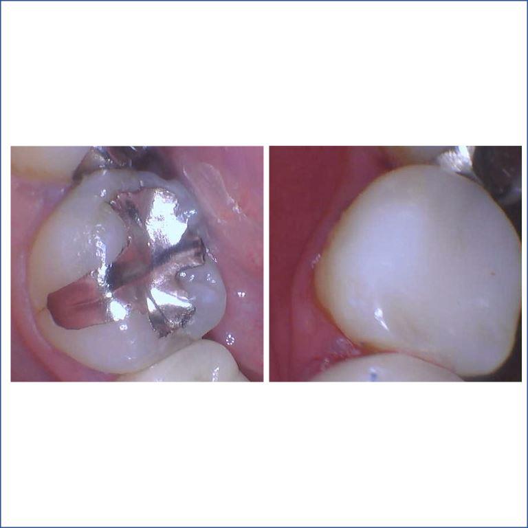7MAOCHIO-BEFORE-AFTER-BIOCLEAR-RESTORATION